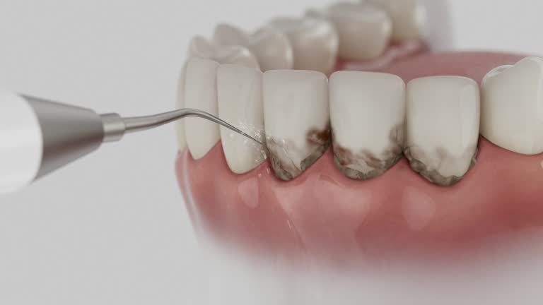 Reliable Dental Implants contractor in Anson County County, NC by Dentist Open Now